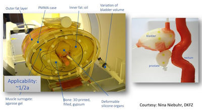 PSMA-data for prostate cancer