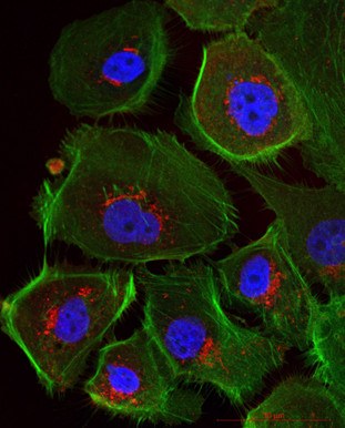 [Translate to Englisch:] Mikroskopische Ansicht menschlicher Eierstockkrebszellen – durch die Immunfluoreszenzfärbung erscheinen Zellkerne blau und das Zellskelett grün. © Uniklinikum Dresden/Klinik für Frauenheilkunde und Geburtshilfe